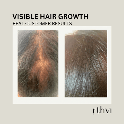 Restore Hair Thickening Serum 2oz