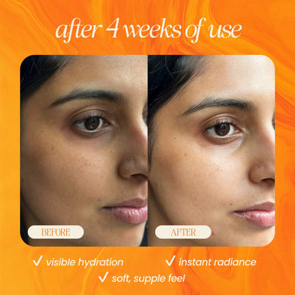 Bakuchiol Skin Renewing Facial Oil (Retinol Alternative)